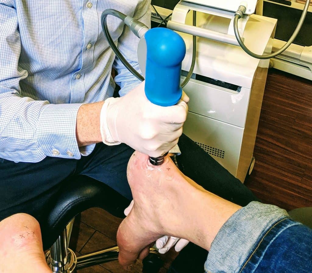 shock-wave-therapy-for-heel-pain-and-plantar-fasciitis