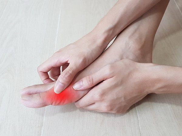 An inflamed arthritic toe joint