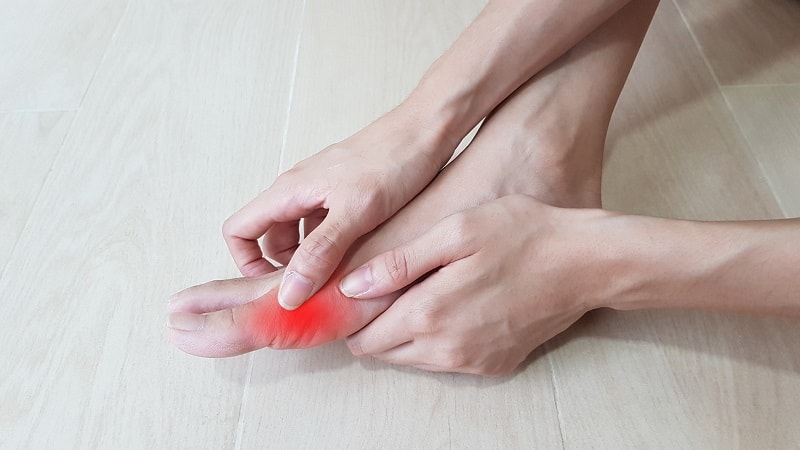 An inflamed arthritic toe joint