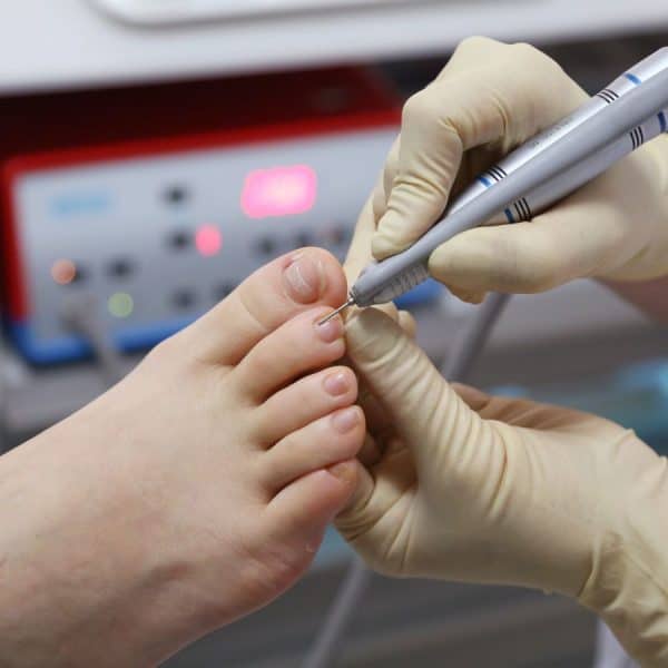 Podiatrist providing nail management and footcare for a diabetic patient.