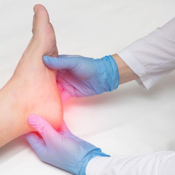 An image of a doctor holding a foot with an inflamed heel
