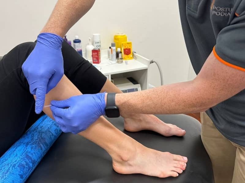 Adelaide Podiatrist, Tom Kolesnik, using dry needling for lower leg pain